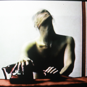 阴部肥胖的图片
